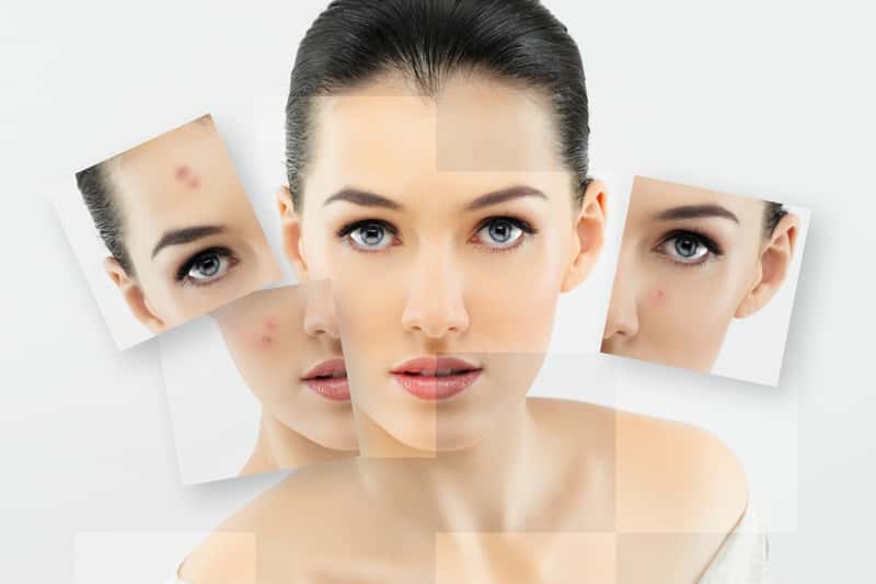 Sch-nheit-im-Wandel-Wie-Hormone-deine-Haut-beeinflussen-und-wie-du-sie-pflegst