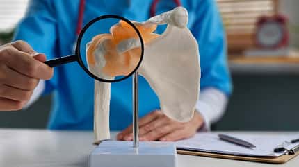 Examination,Of,A,Shoulder,Joint,Model,With,A,Magnifying,Glass