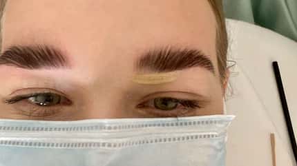 Brow-Lift im Test Brow-Lift im Test