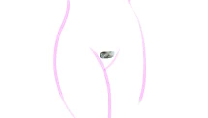 Intimrasur Europäisch