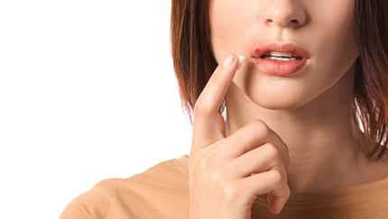 Bereits bei den ersten Anzeichen eines Lippenherpes sollte man schnell handeln
