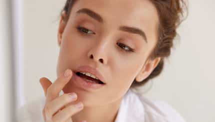 Trockene Lippen