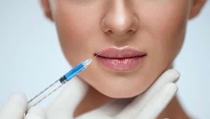 Schicke Lippe? Das bringt die Hyaluronsäure-Spritze
