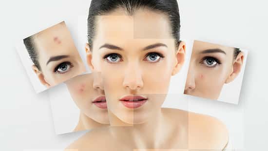 Alles über unreine Haut