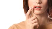 Bereits bei den ersten Anzeichen eines Lippenherpes sollte man schnell handeln